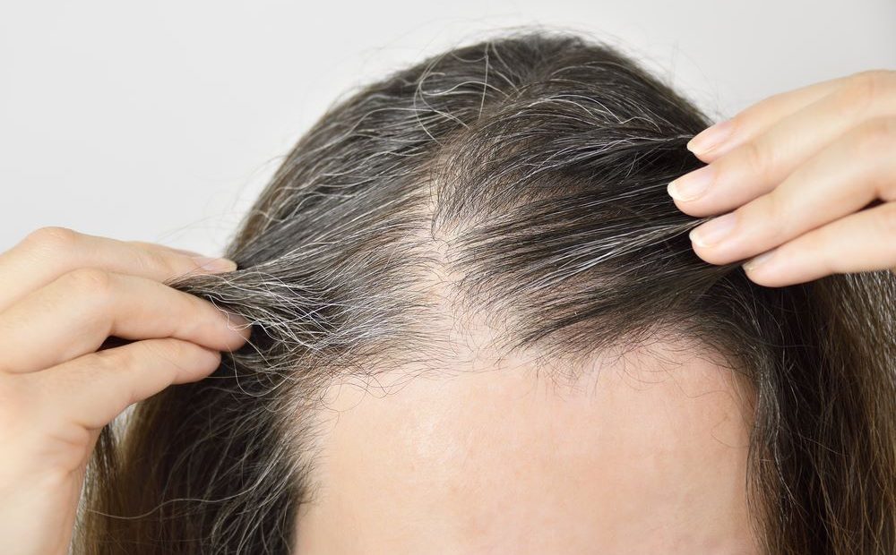Bài thuốc đông y chữa trị tóc bạc sớm