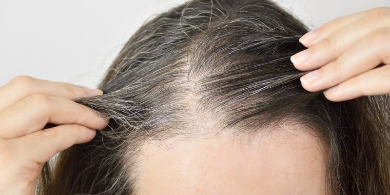Bài thuốc đông y chữa trị tóc bạc sớm