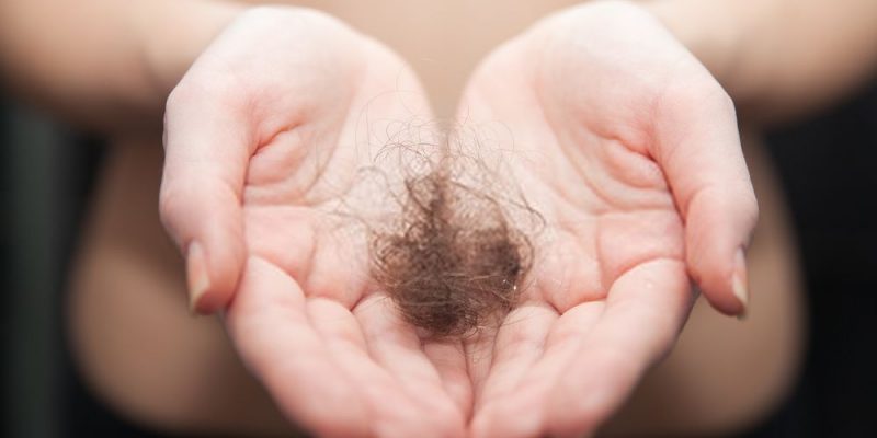 Bệnh nào khiến tóc rụng và hói đầu vĩnh viễn